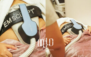 MOLD Manila Introduces Revolutionary Emsculpt Treatment for Non-Surgical Body Contouring